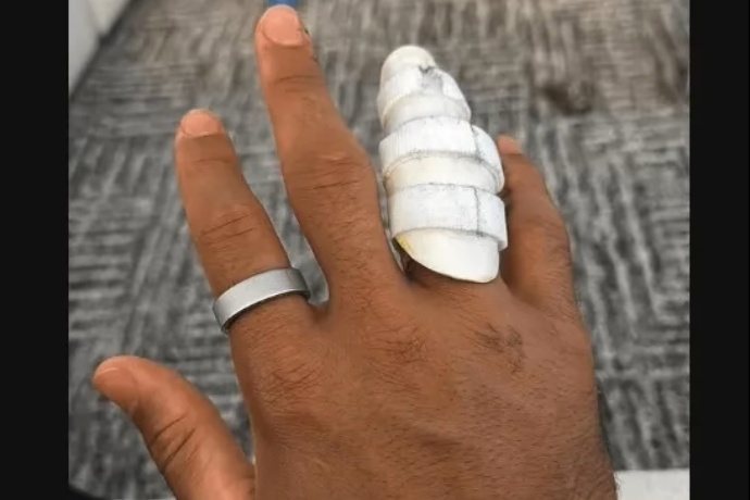 哈特在社交媒体上晒自己术后无名指佩戴护具照片